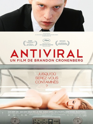 病毒抗体 (2012)